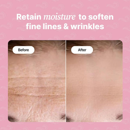 Forehead Wrinkle Patches | Anti-Wrinkle Facial Patches for Fine Lines | Overnight Wrinkle Filler & Deep Line Treatment | Disposable Face Tape for a Youthful, Firmer, and Smoother Appearance | 20 Count