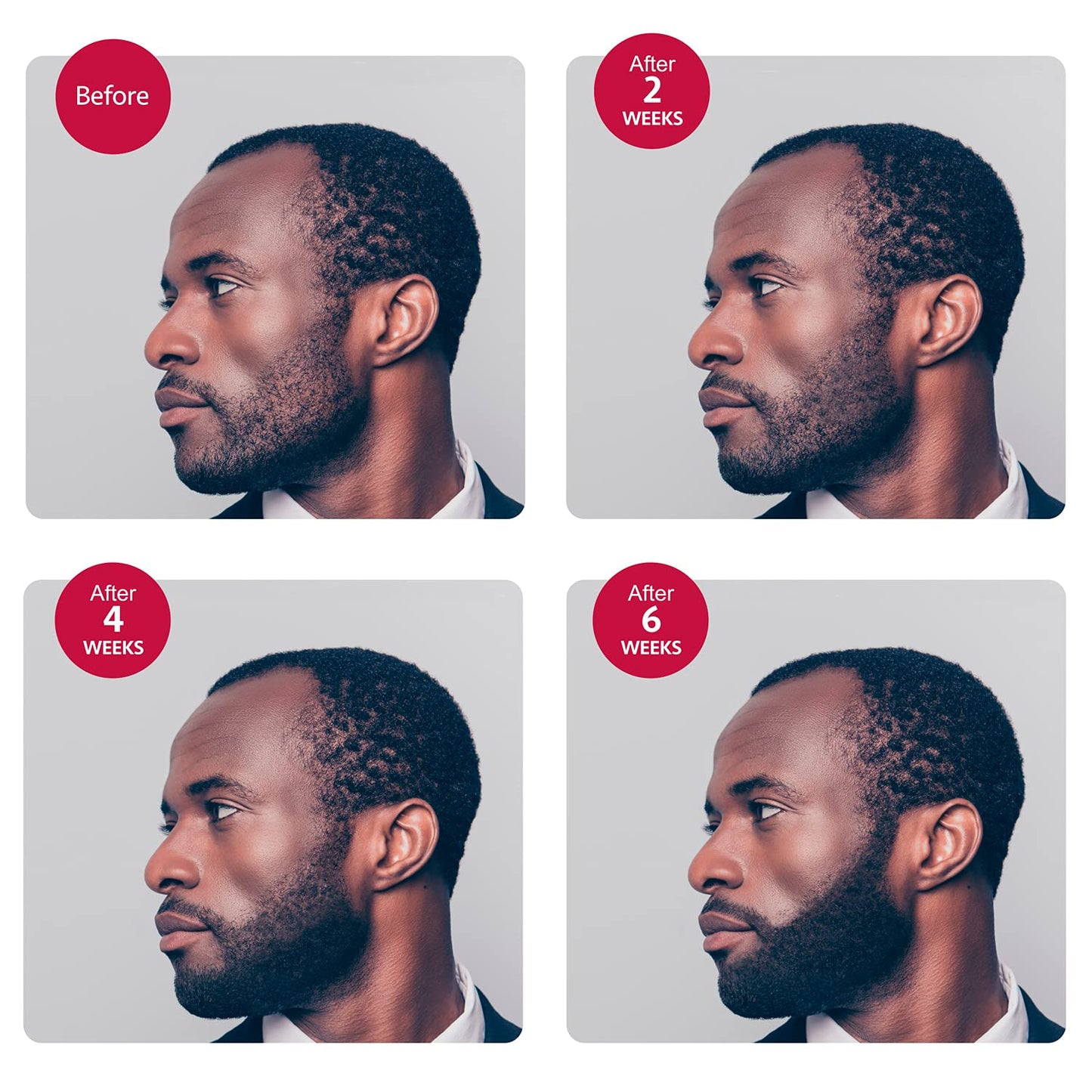 Godefroy Thick Beard and Mustache Serum For Ethnic Hair Types, 15 ml