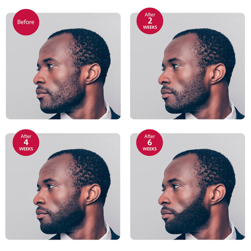 Godefroy Thick Beard and Mustache Serum For Ethnic Hair Types, 15 ml