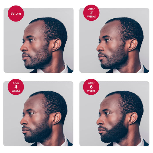 Godefroy Thick Beard and Mustache Serum For Ethnic Hair Types, 15 ml